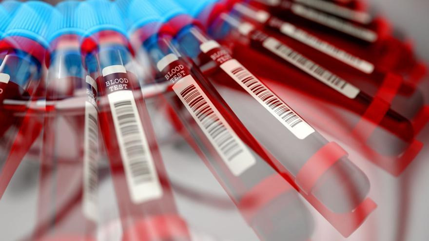 La estafa de los test de intolerancias alimentarias: el negocio millonario que explota la salud