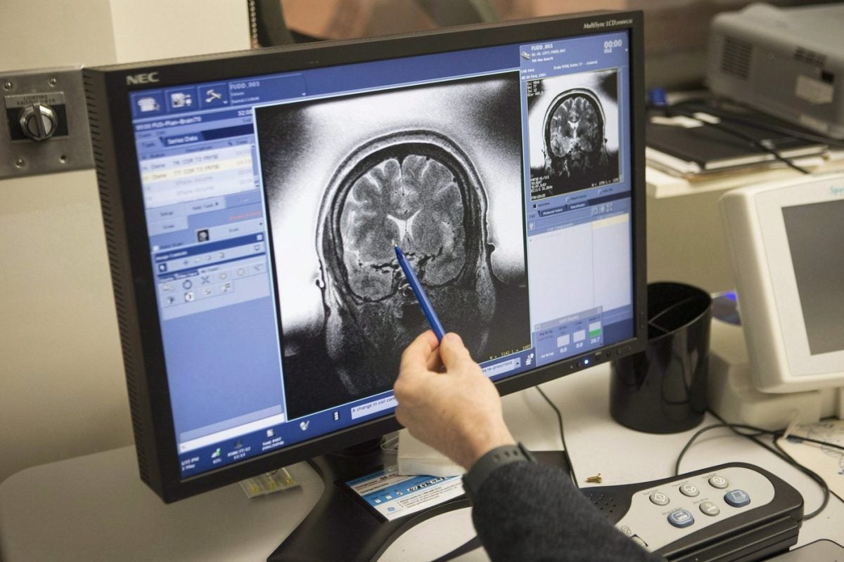 Image d'illustration pour: L'anorexie associée à des altérations majeures du cerveau | L'actualité