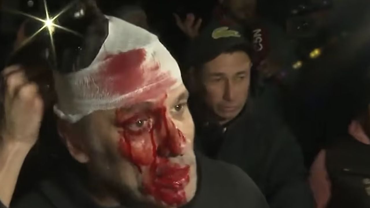 Image d'illustration pour: Incidentes en el acto de LLA: peleas, un botellazo a un periodista y piedrazos
