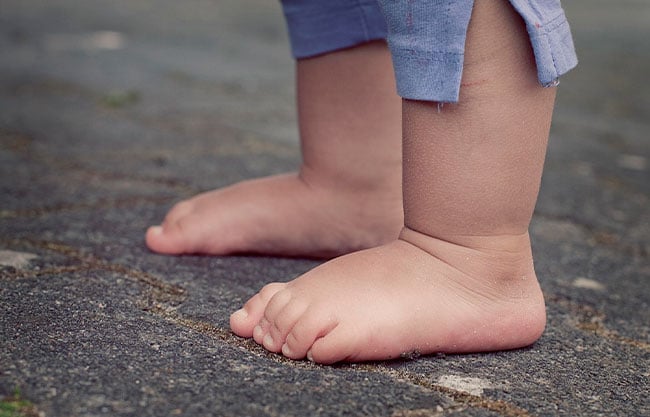 Image d'illustration pour: El 38% de los niños con sobrepeso u obesidad sufre dolores en piernas y pies | Periódico Zócalo | Noticias de Saltillo, Torreón,  Piedras Negras, Monclova, Acuña
