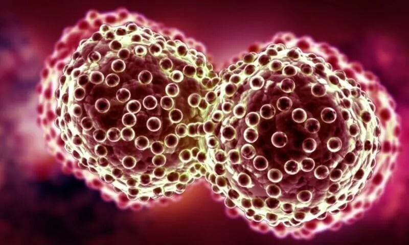 Image d'illustration pour: Pakistan to establish National Cancer Registry as President Zardari approves bill (Copy)
