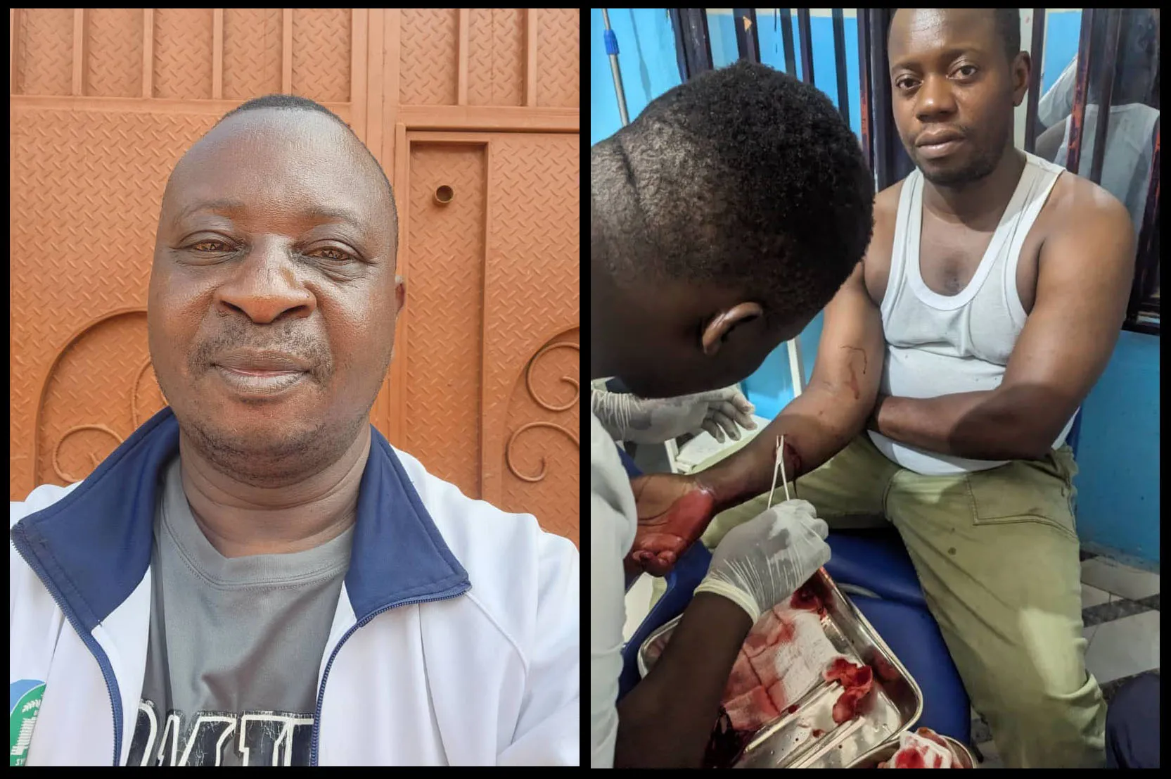 Image d'illustration pour: In eastern DRC, journalist faces knife attack, threats, another detained 3 times - Committee to Protect Journalists